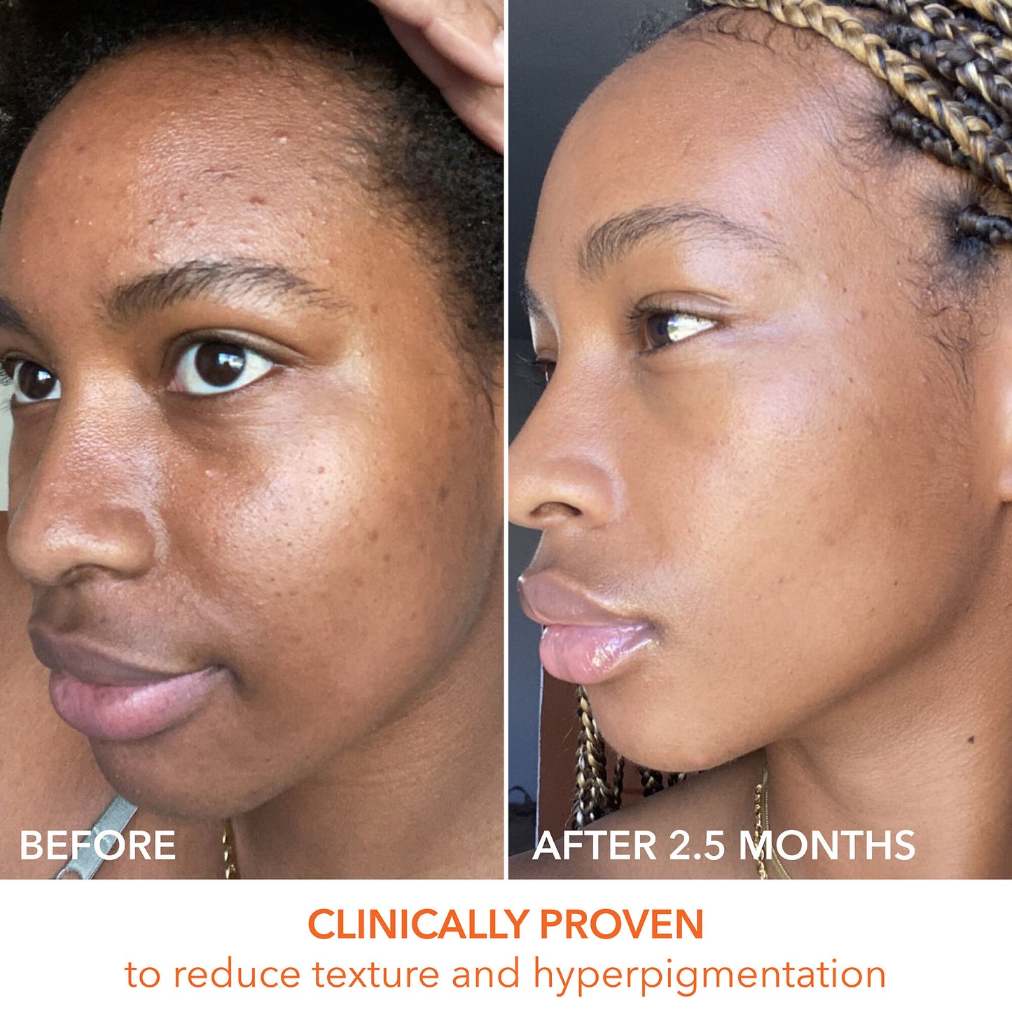 Alpha Beta Universal Daily Peel