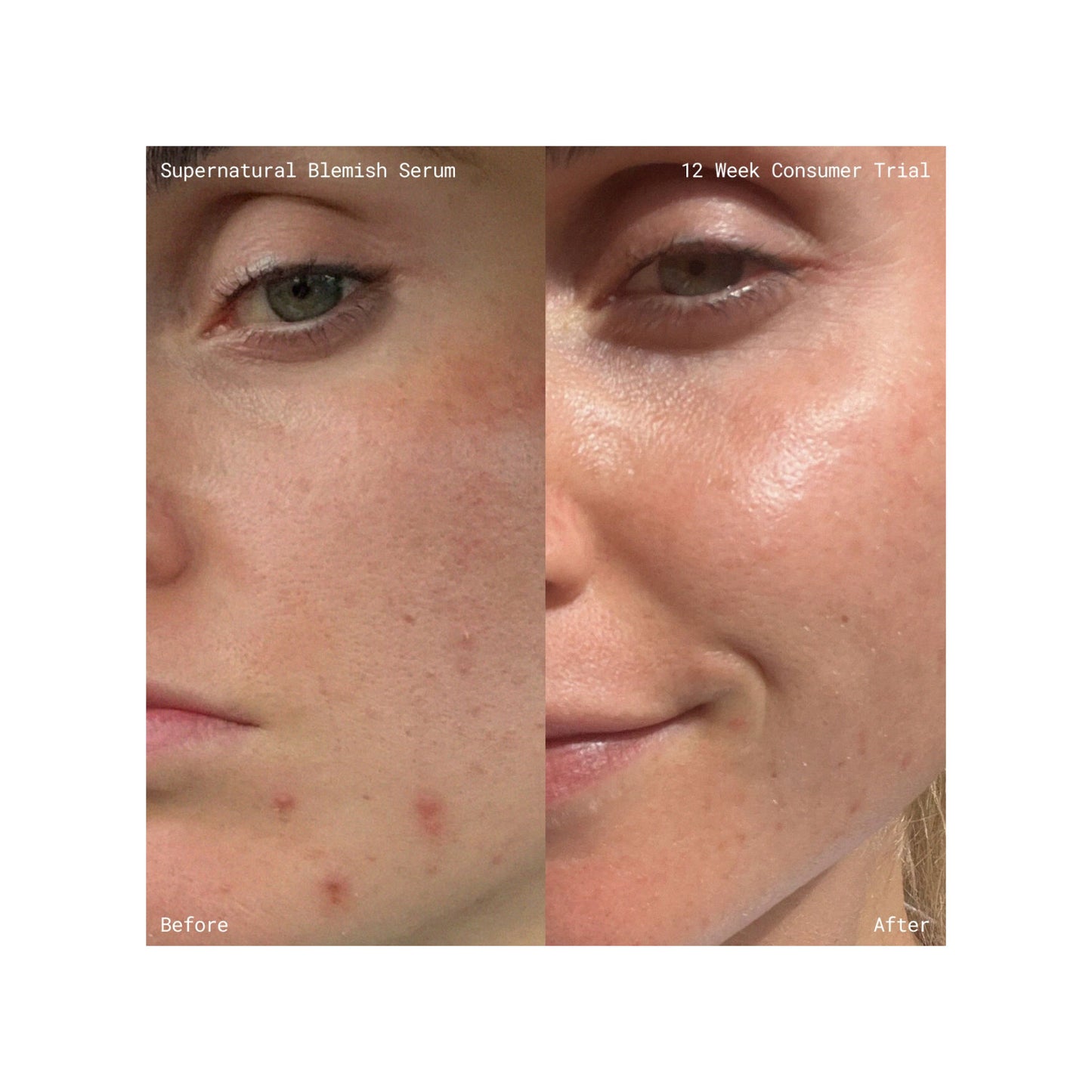Supernatural Blemish Face Serum