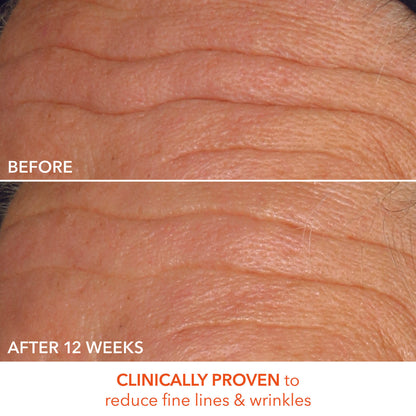 Alpha Beta Universal Daily Peel