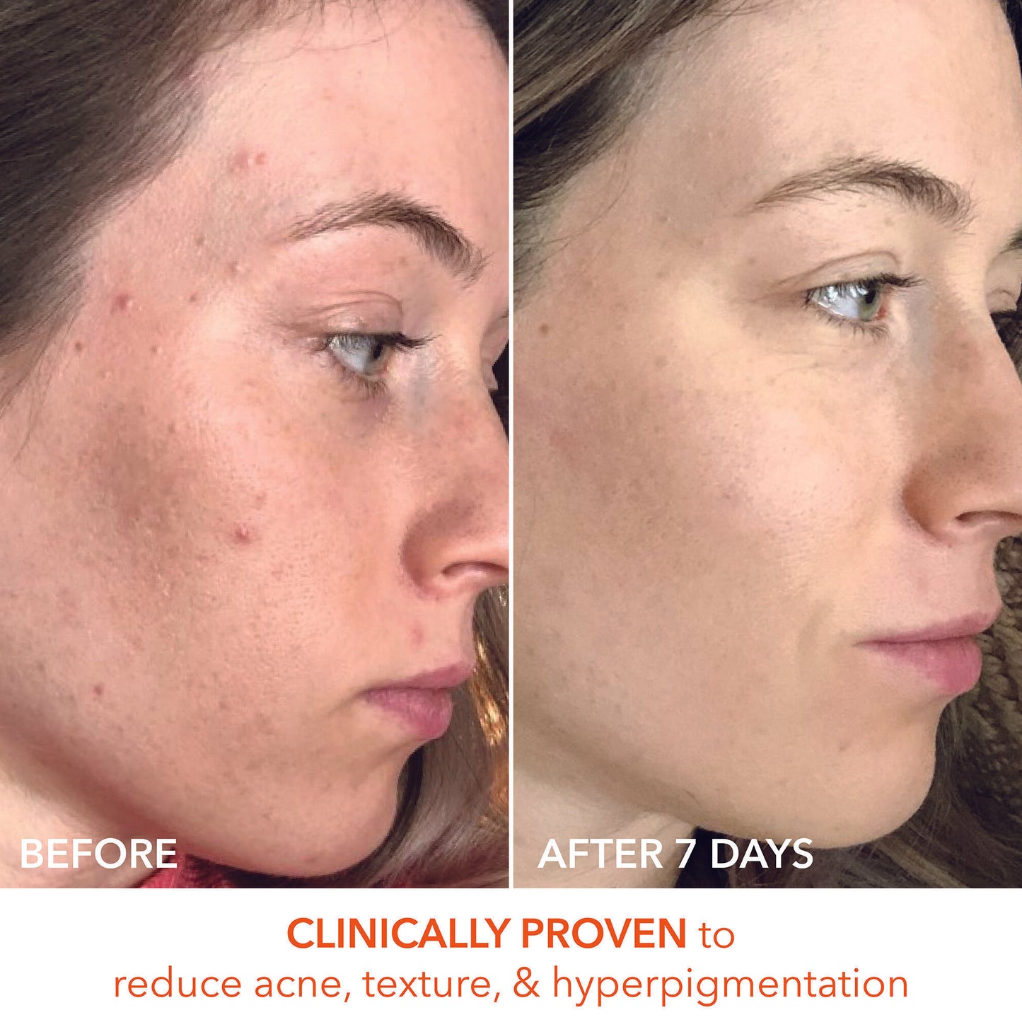 Alpha Beta Universal Daily Peel
