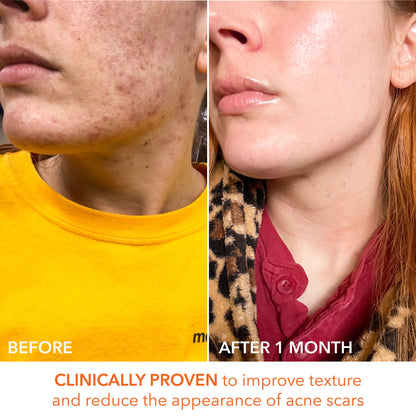 Alpha Beta Universal Daily Peel