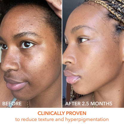 Alpha Beta Universal Daily Peel