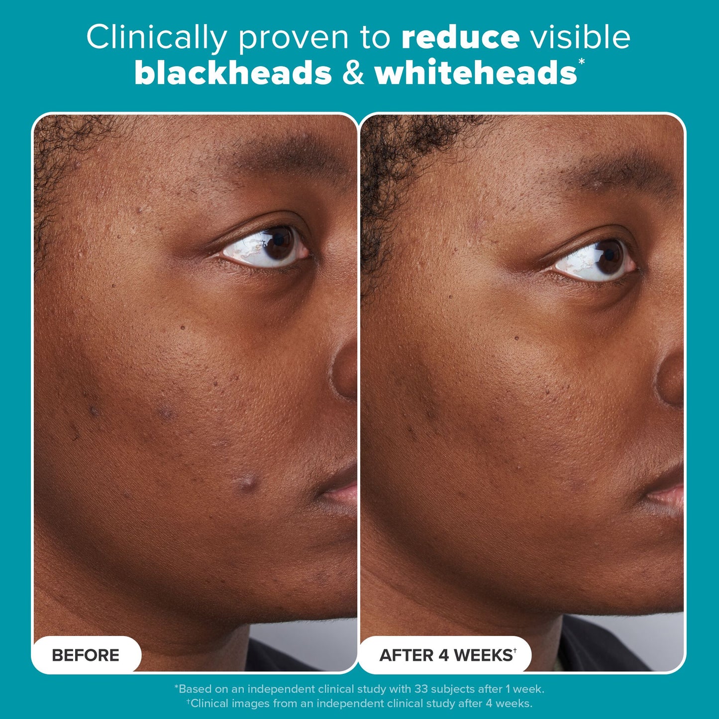 Skin Perfecting 2% BHA Liquid Exfoliant