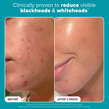 Skin Perfecting 2% BHA Liquid Exfoliant