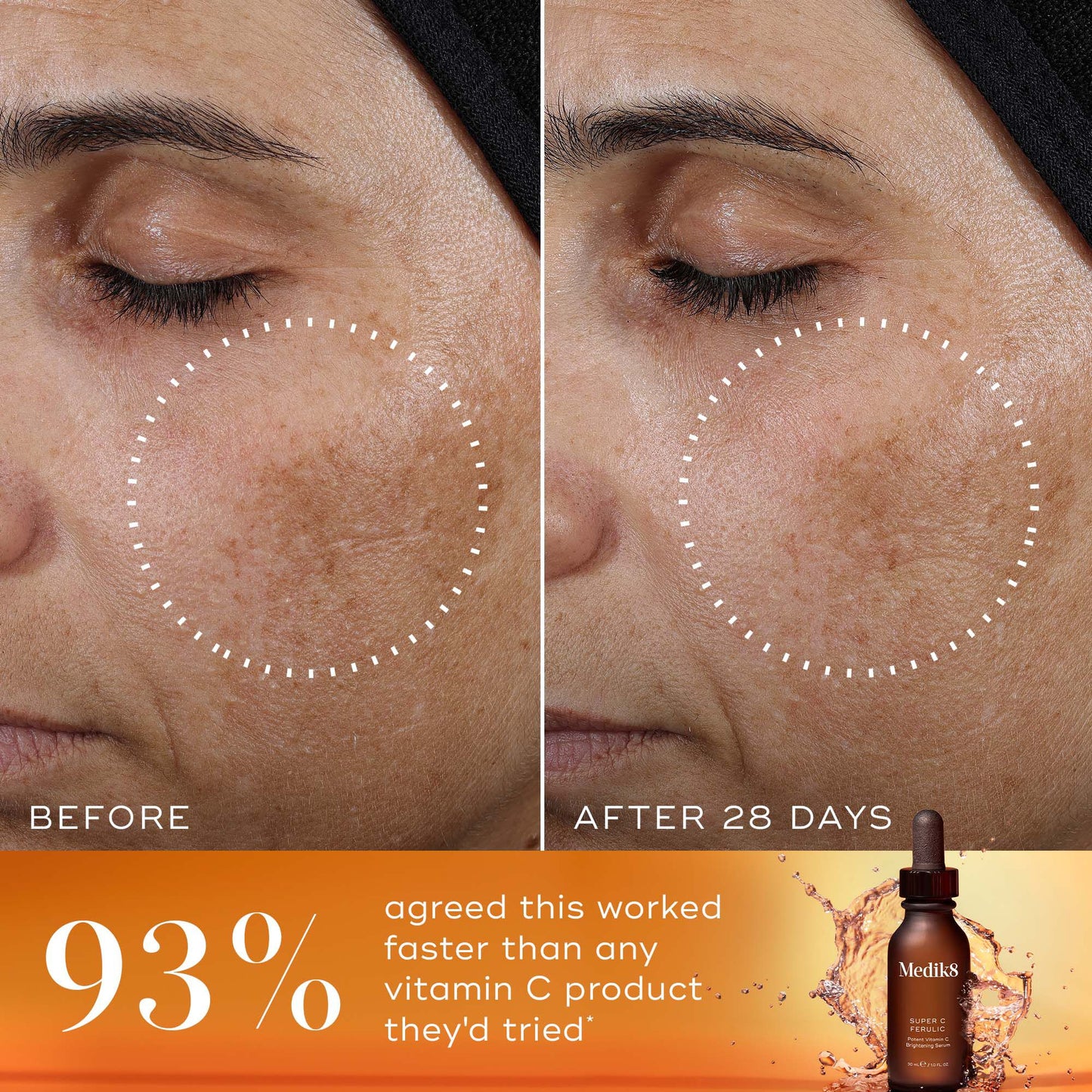 Super C Ferulic