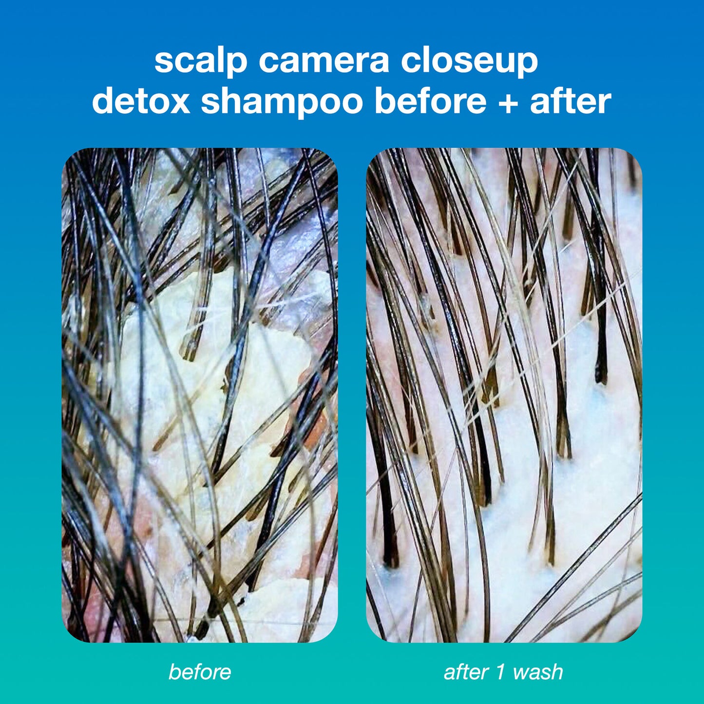 PEPTIDE PREP™ detox shampoo