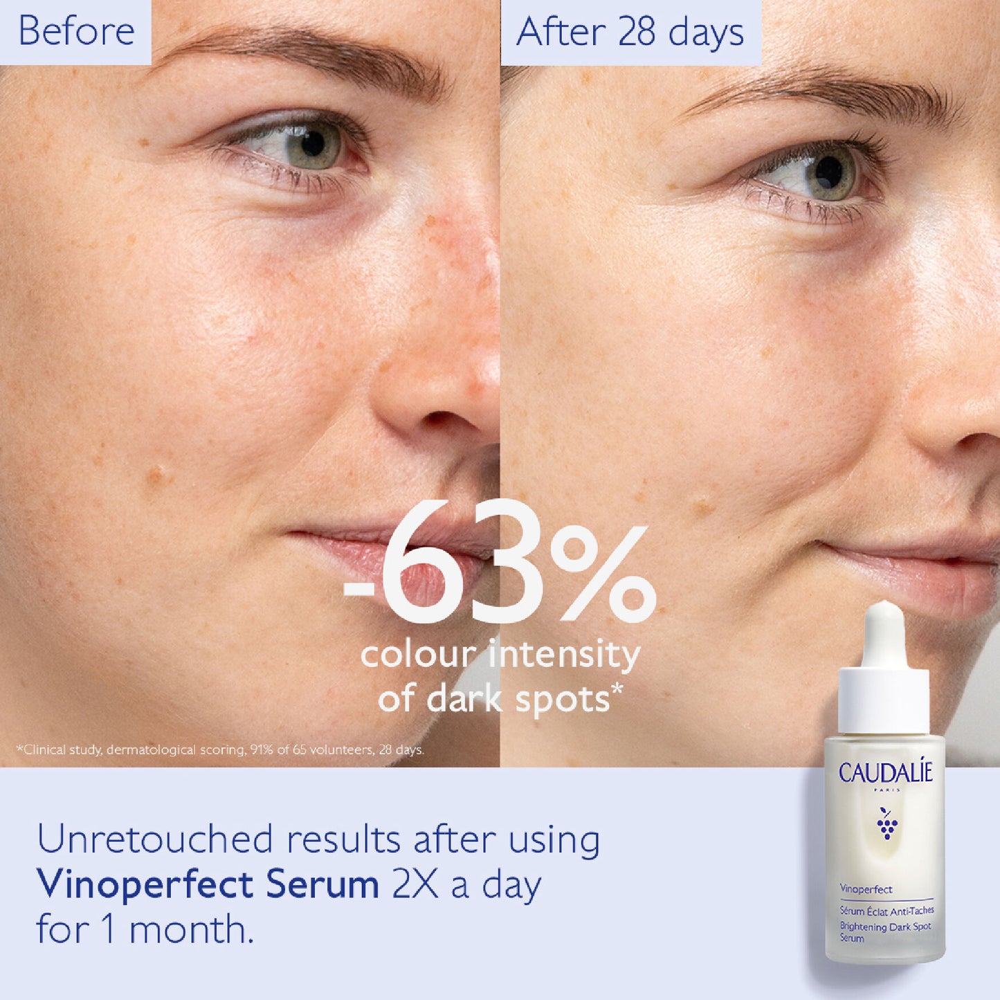 Vinoperfect Brightening Dark Spot Serum