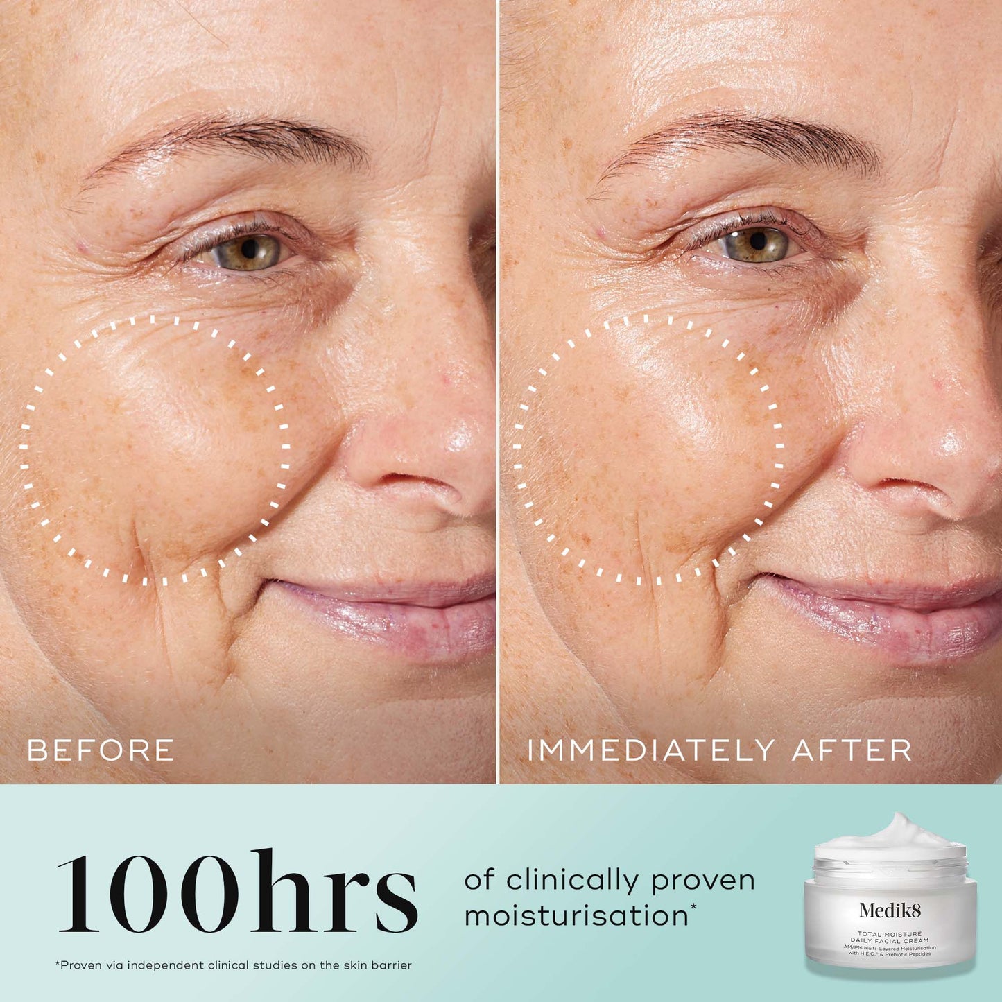 Total Moisture Daily Facial Cream Refill