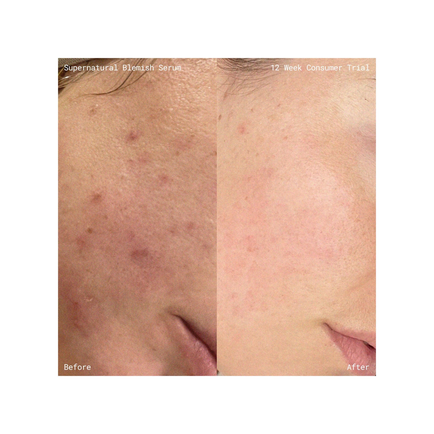 Supernatural Blemish Face Serum