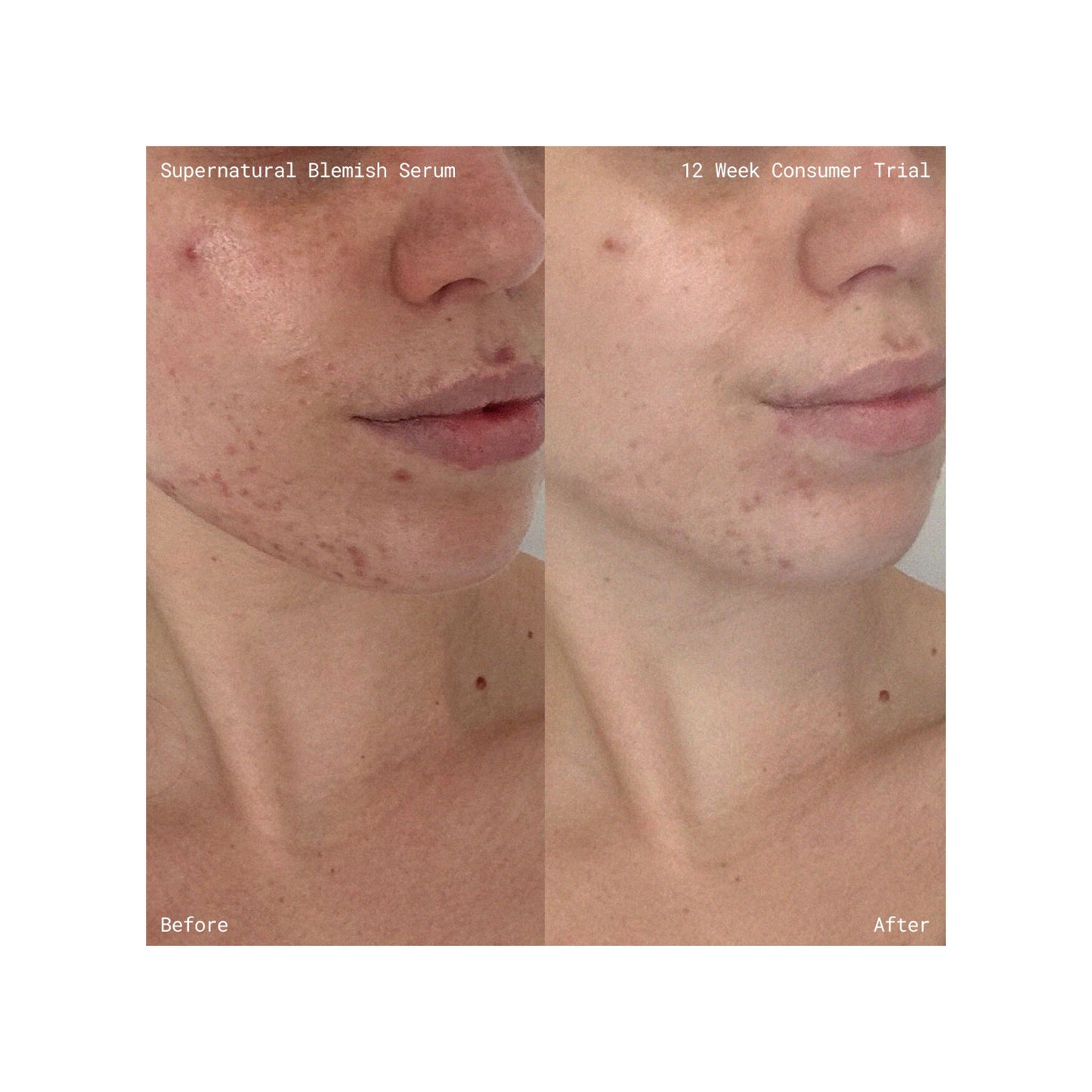 Supernatural Blemish Face Serum