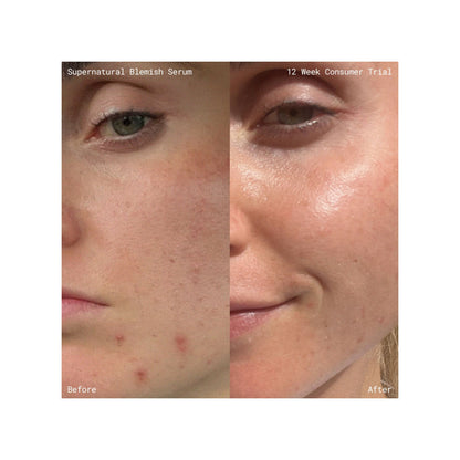 Supernatural Blemish Face Serum