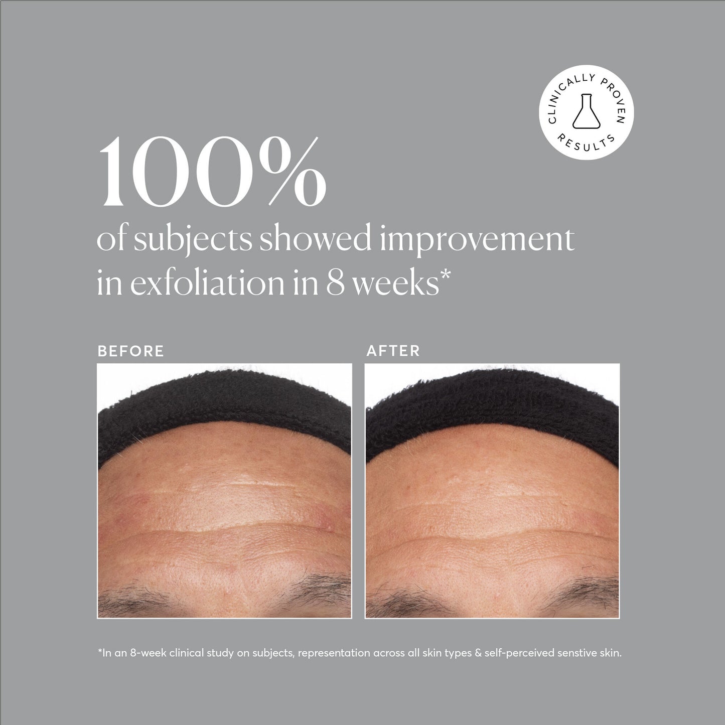 Azelaic Acid 10%