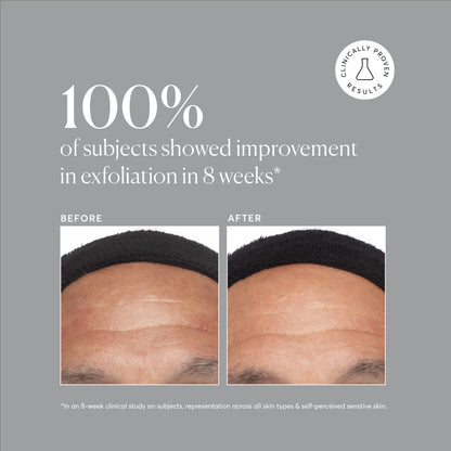 Azelaic Acid 10%
