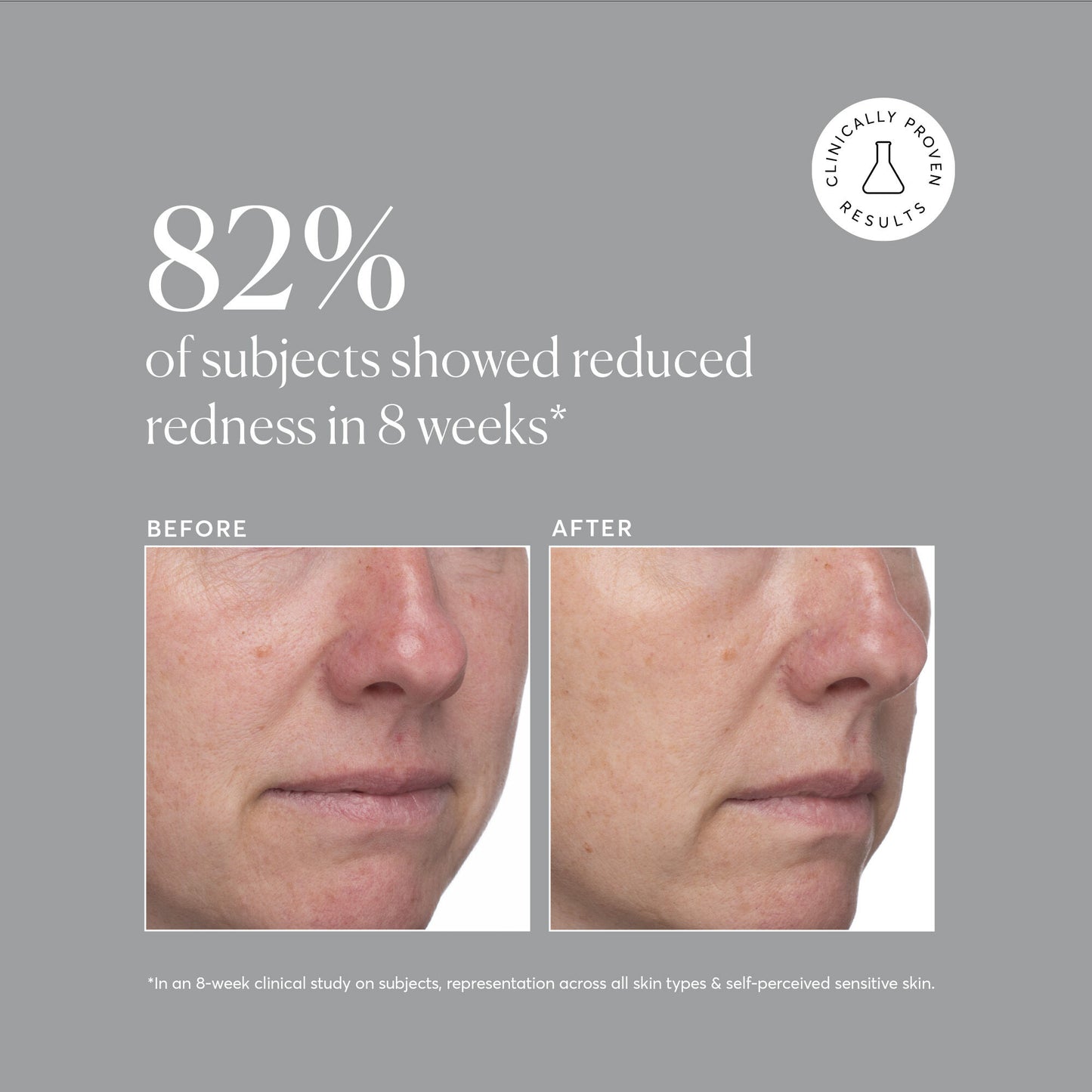 Azelaic Acid 10%