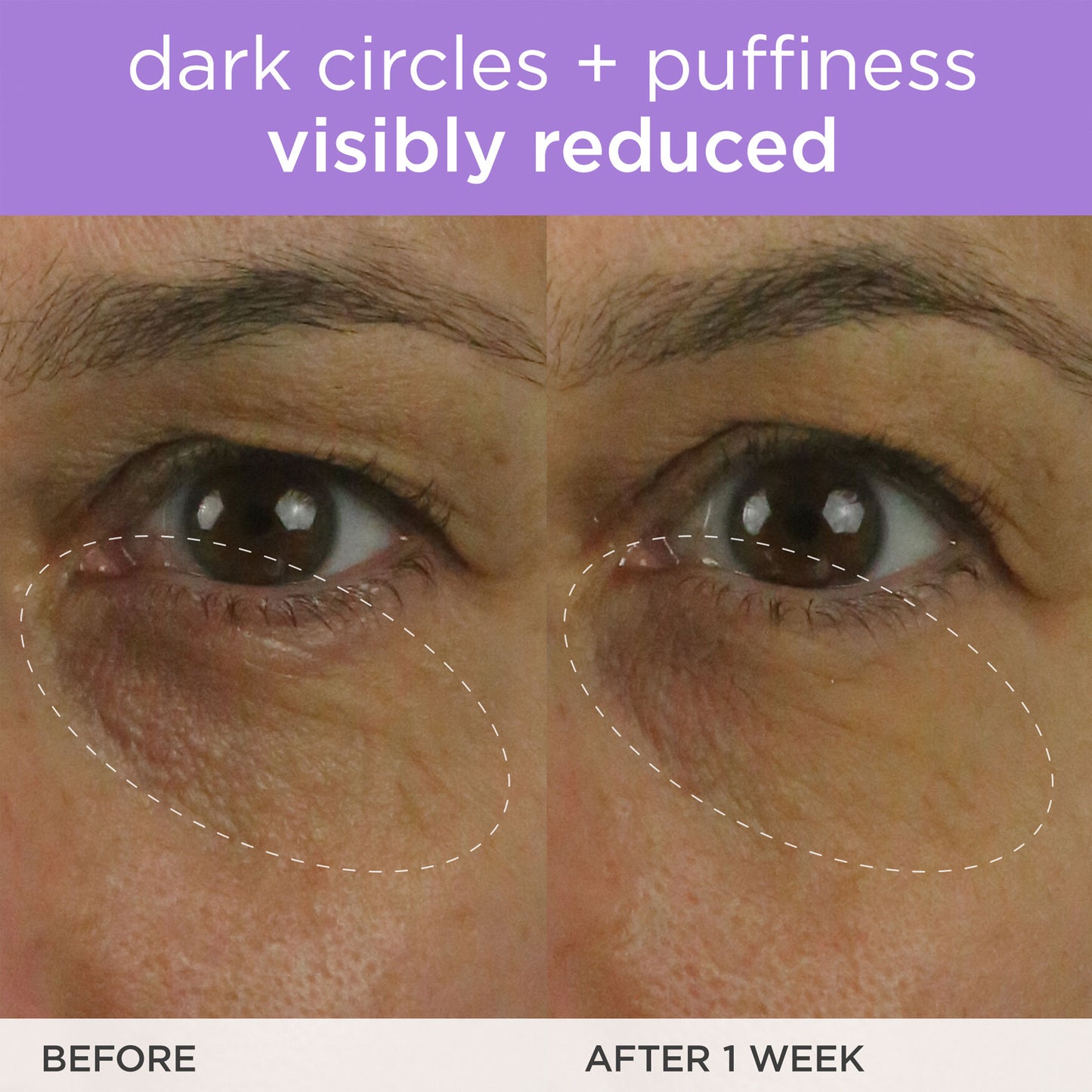 The Brightening Eye Cream