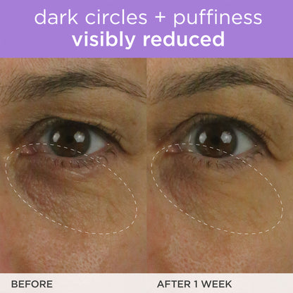 The Brightening Eye Cream