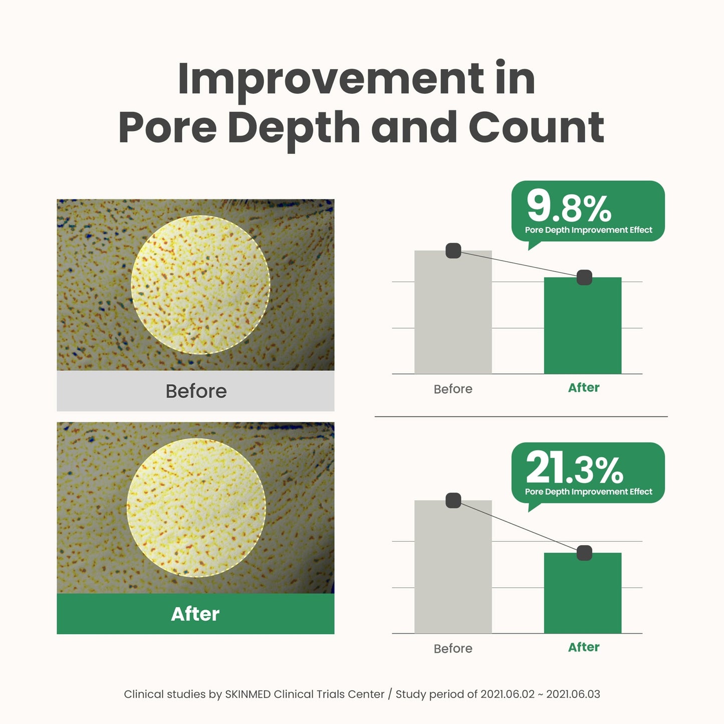 AXIS-Y Mugwort Pore Clarifying Wash Off Pack - Image 5