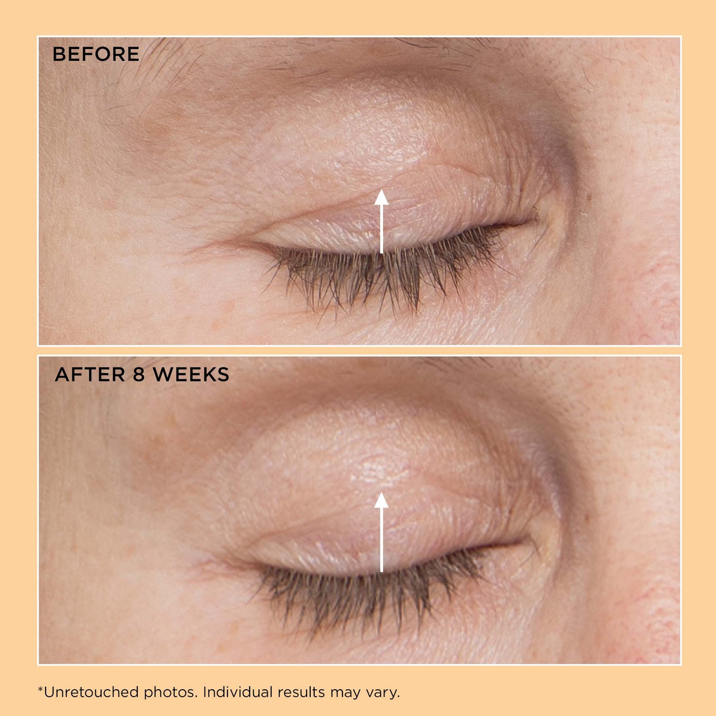 Perricone MD Neuropeptide Eyelid Lift Serum - Image 4