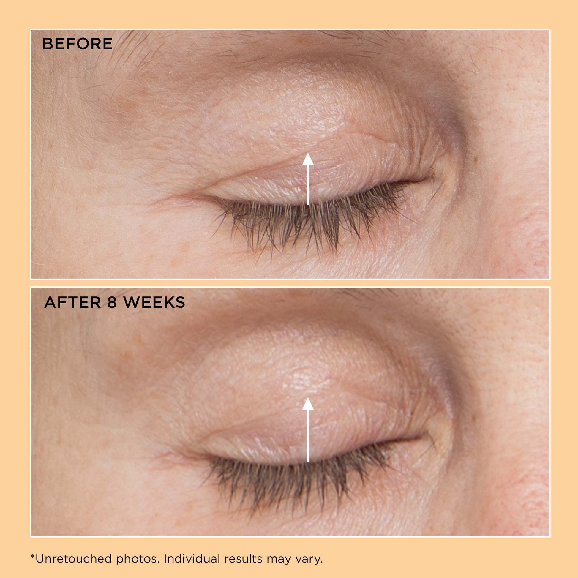 Perricone MD Neuropeptide Eyelid Lift Serum - Image 4