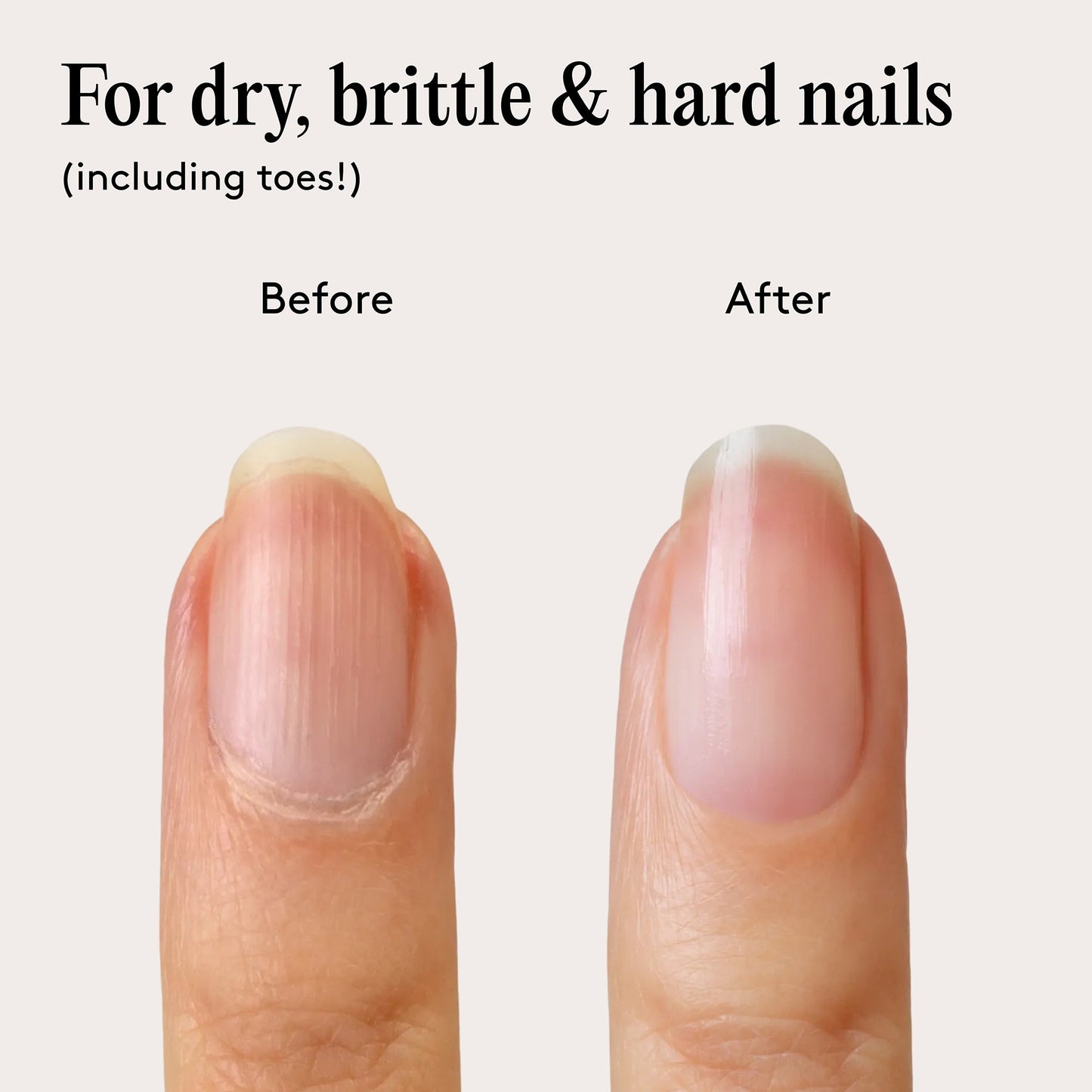 Mylee Barrier Boost Nail Serum - Image 7