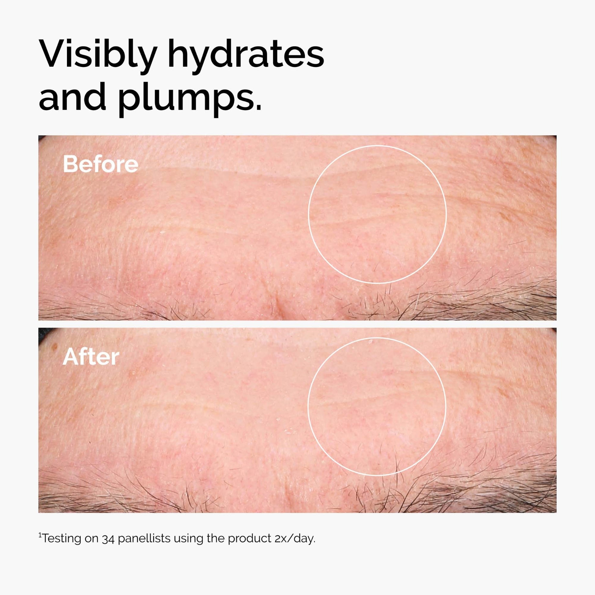 The Ordinary Brighten & Hydrate Bundle - Image 7