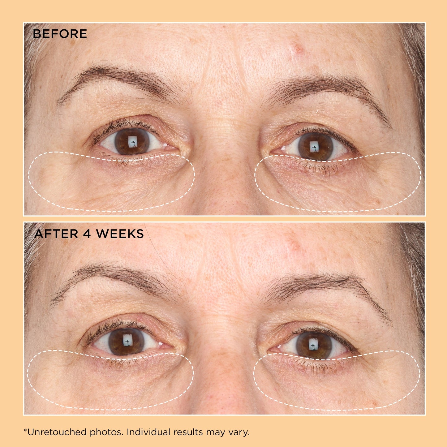 Perricone MD Neuropeptide Corrective Brightening Under-Eye Cream - Image 4