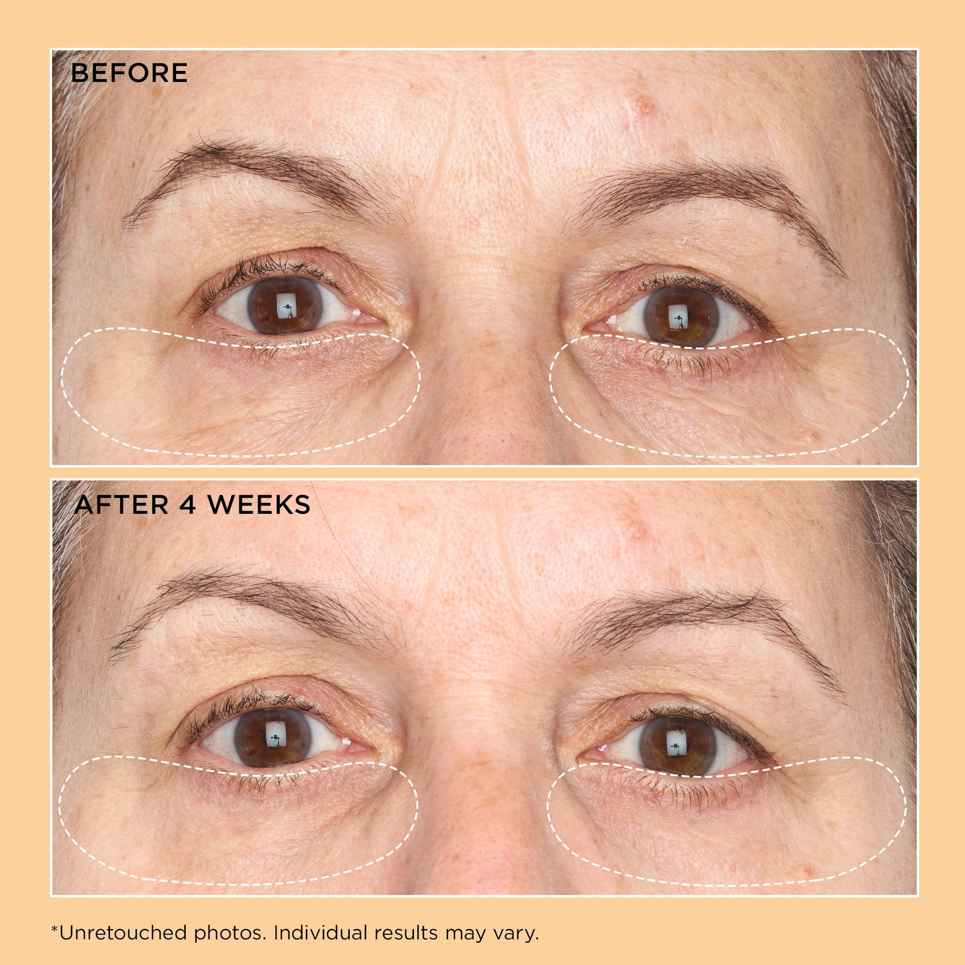 Perricone MD Neuropeptide Corrective Brightening Under-Eye Cream - Image 4