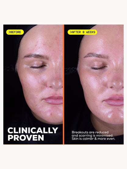 Glow Hub The Scar Slayer Facial Serum - Image 9