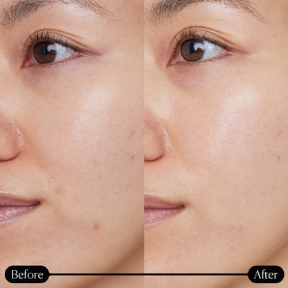 ELEMIS Dynamic Resurfacing Super-C Serum - Image 4