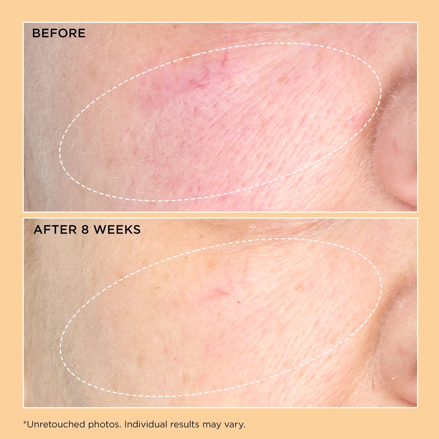 Perricone MD Neuropeptide Pro-Strength Firming Moisturiser - Image 4