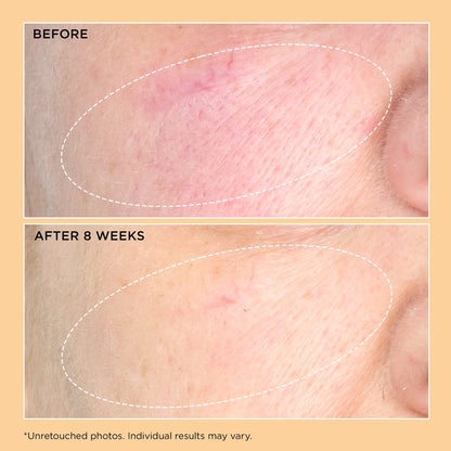 Perricone MD Neuropeptide Pro-Strength Firming Moisturiser - Image 4