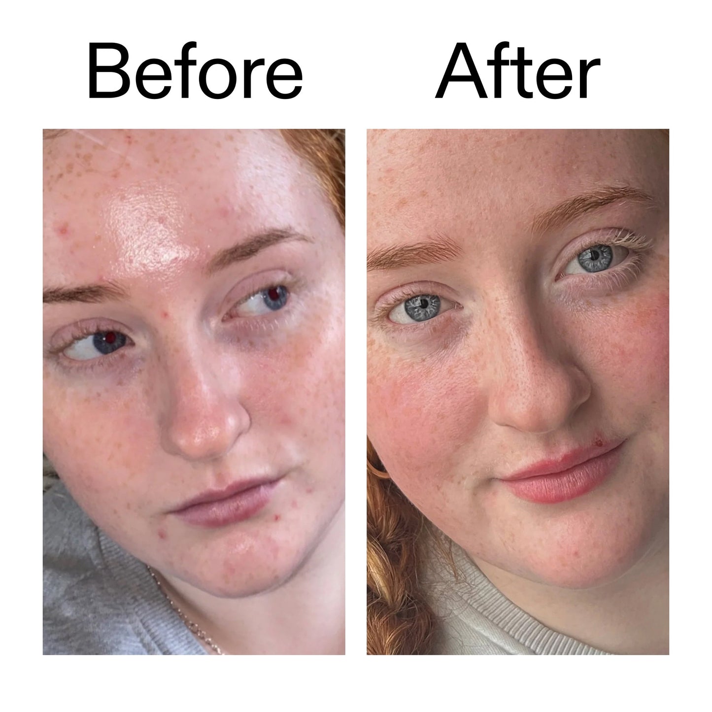 The INKEY List Vitamin B, C and E Moisturizer - Product Details