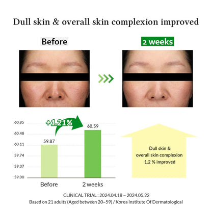 Dr. Althea Gentle Vitamin C Serum - Image 5