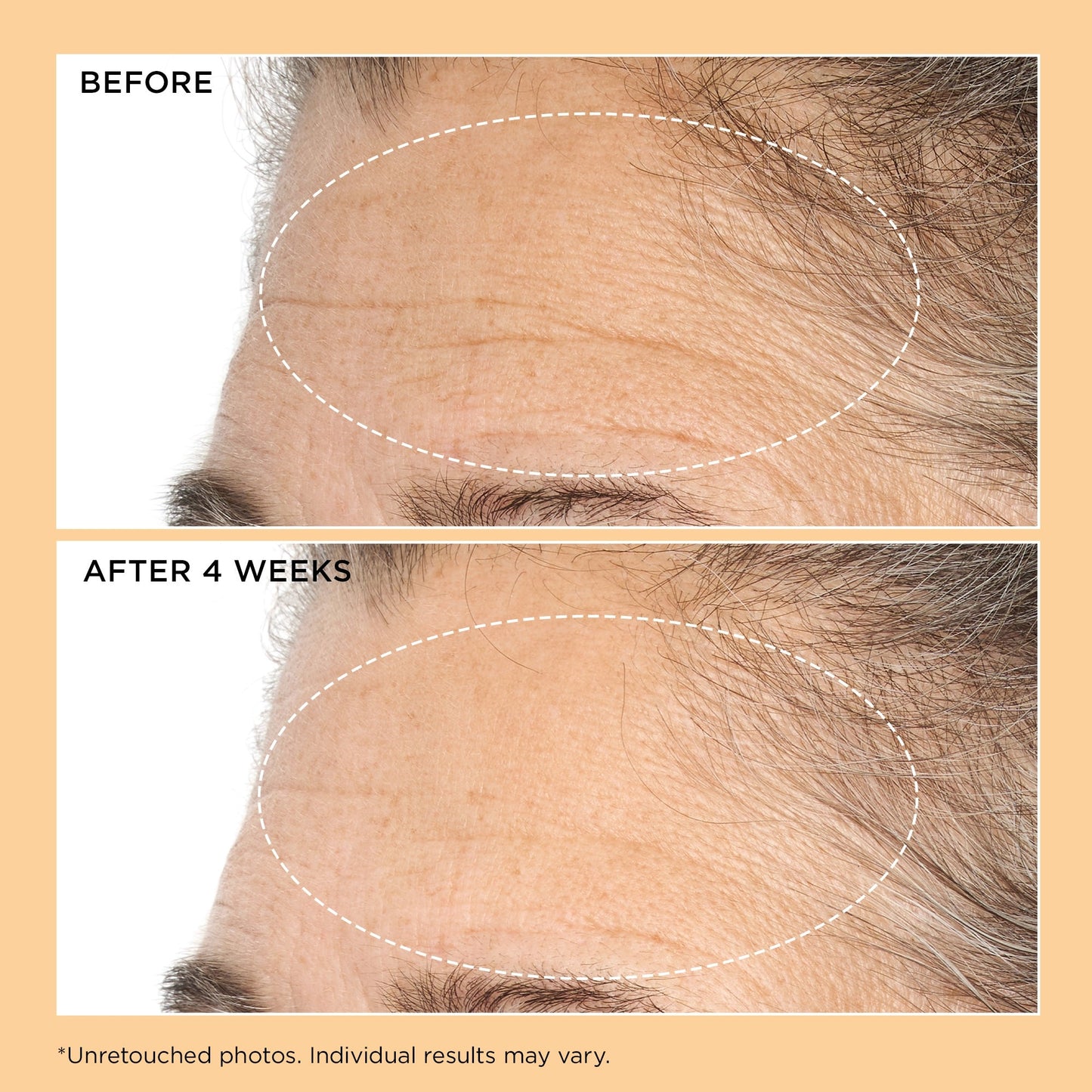 Perricone MD Neuropeptide Deep Crease Serum - Application