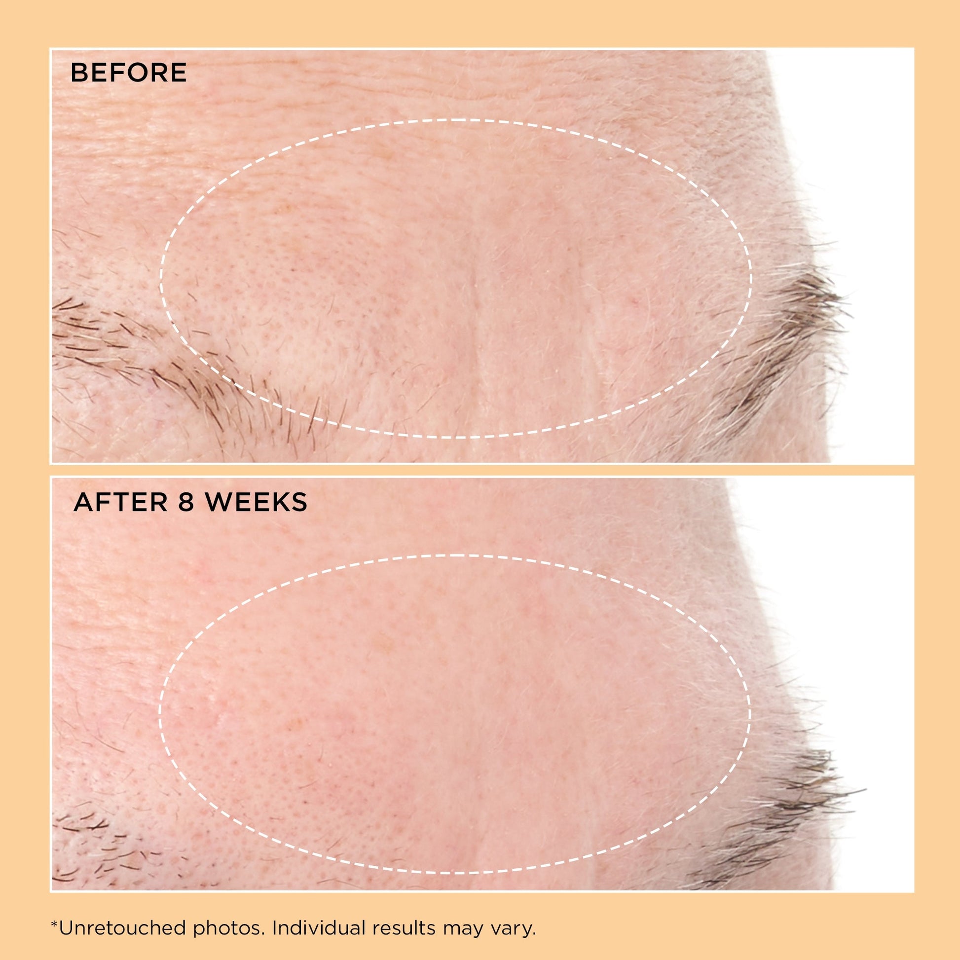 Perricone MD Neuropeptide Deep Crease Serum - Image 4