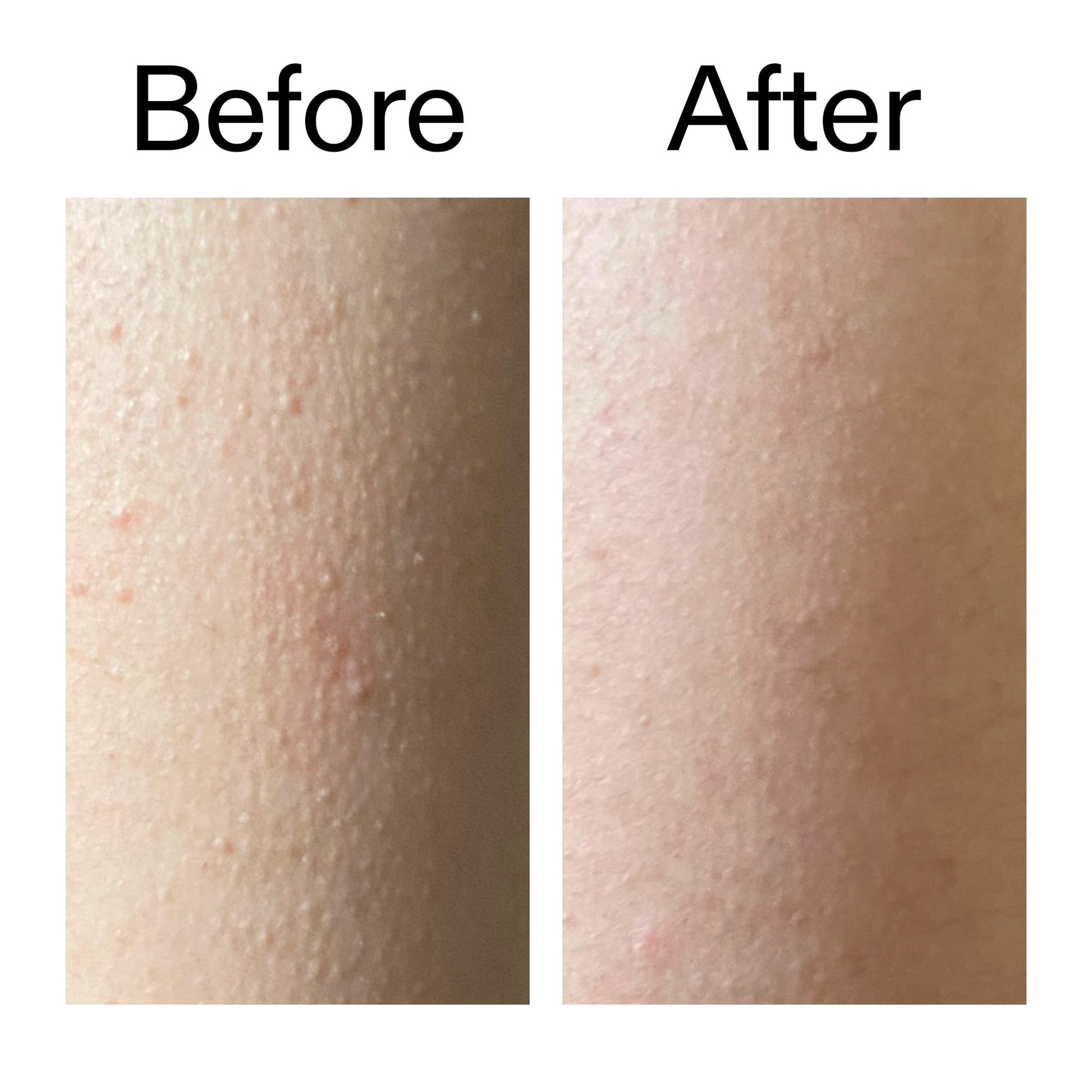 The INKEY List Glycolic Acid Exfoliating Body Stick - Product Details