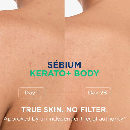 Bioderma Sebium Kerato+ Body Spray - Image 4