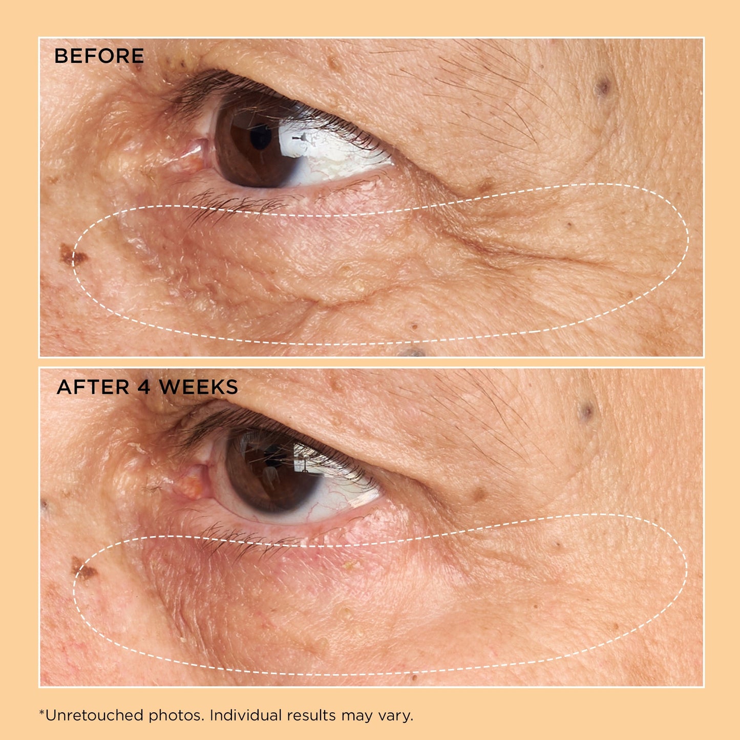 Perricone MD Neuropeptide Corrective Brightening Under-Eye Cream - Application