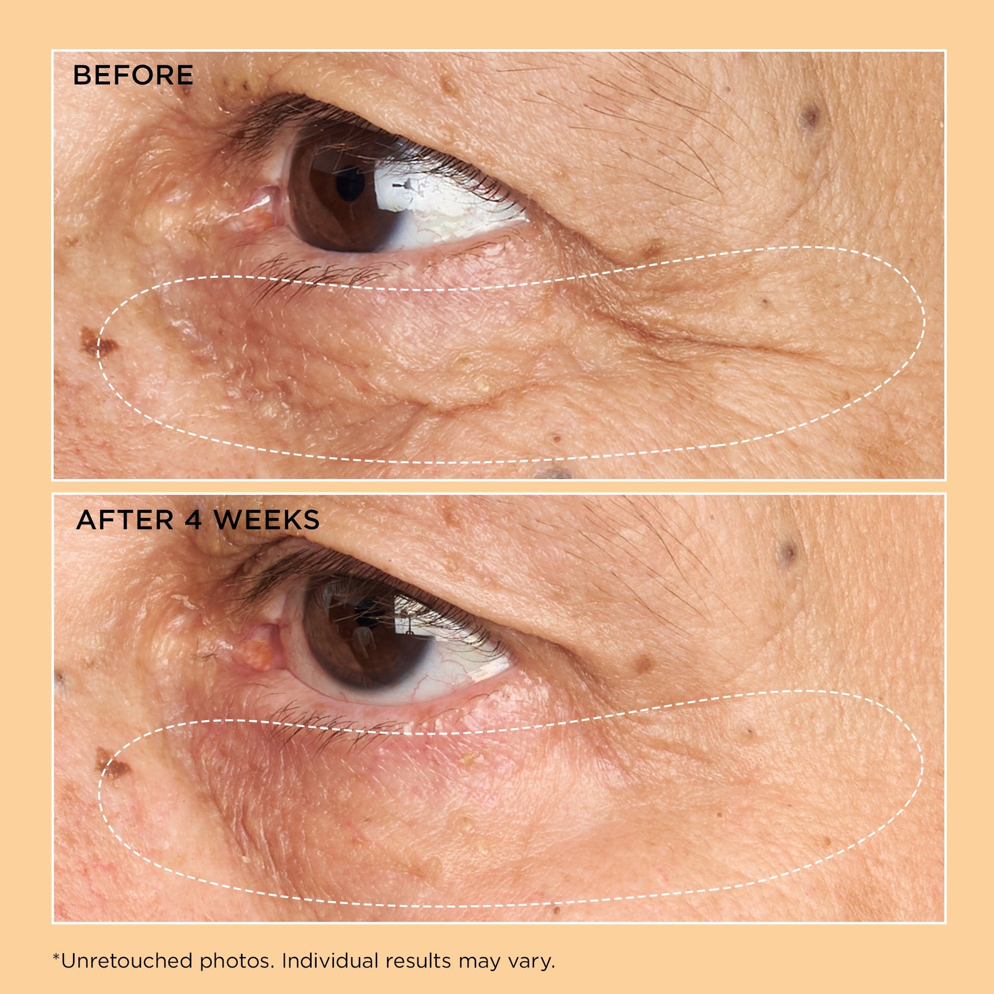 Perricone MD Neuropeptide Corrective Brightening Under-Eye Cream - Application