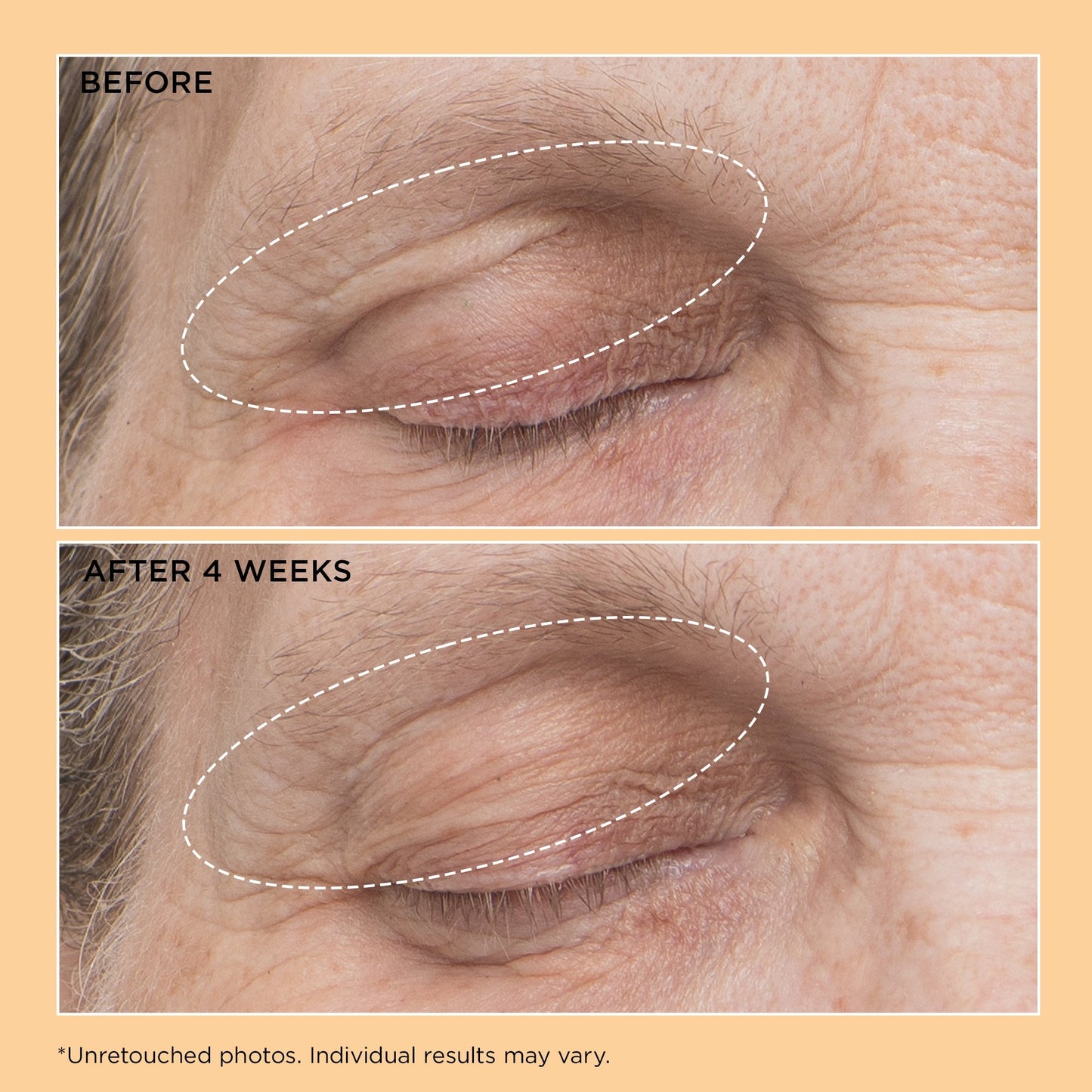 Perricone MD Neuropeptide Eyelid Lift Serum - Application