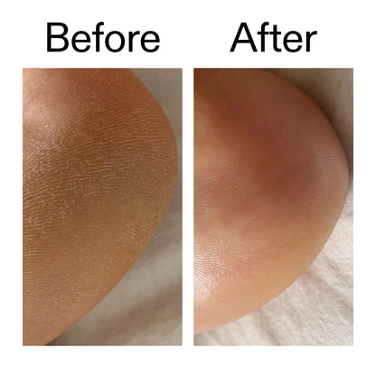 The INKEY List Glycolic Acid Exfoliating Body Stick - Application