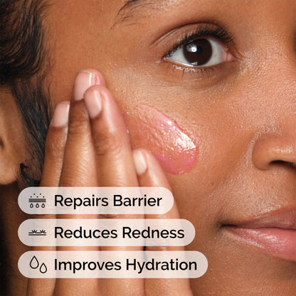 The Ordinary Soothing and Barrier Support Serum - Image 5