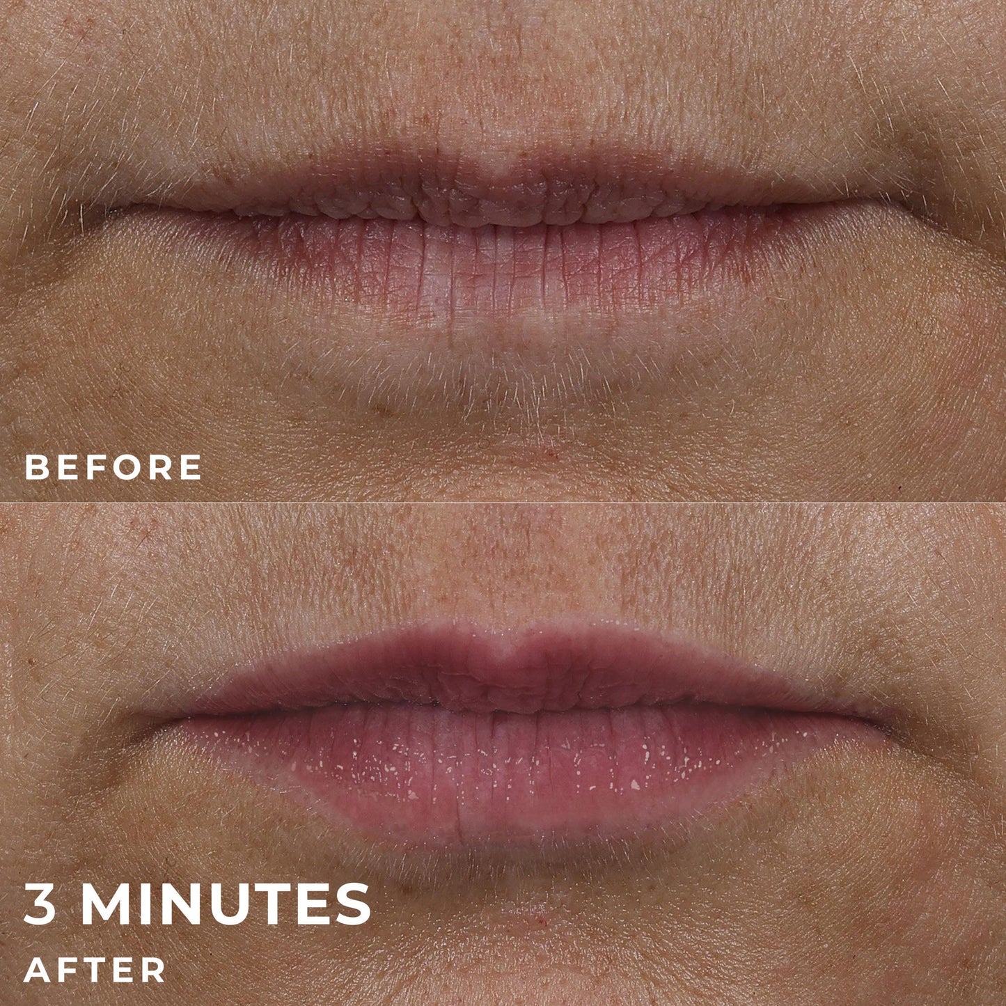 RoC Skincare Derm Correxion Lip Volumiser - Application