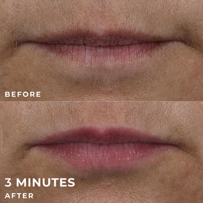 RoC Skincare Derm Correxion Lip Volumiser - Application