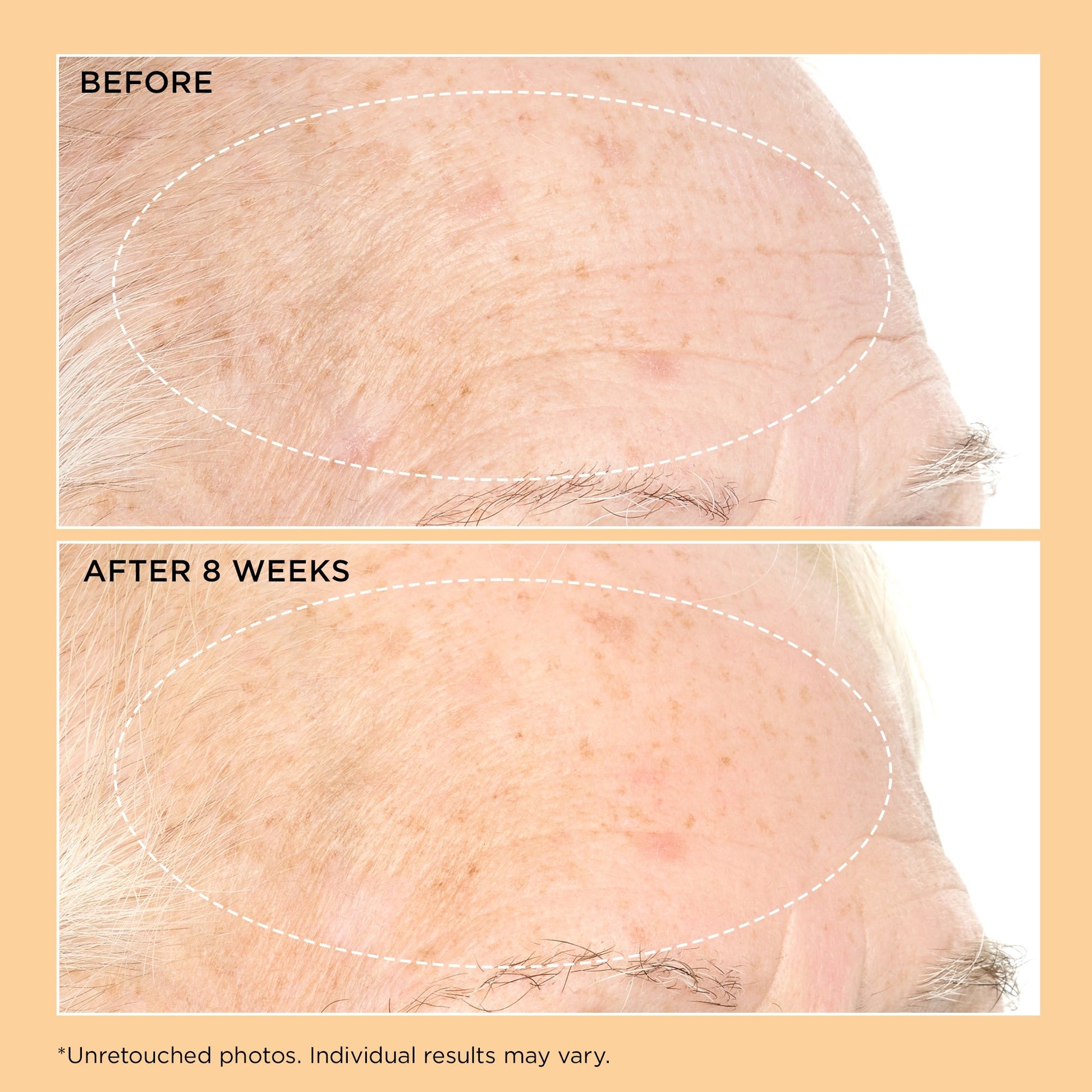 Perricone MD Neuropeptide Pro-Strength Firming Moisturiser - Application