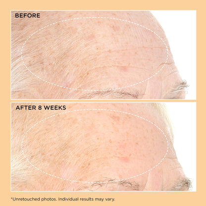 Perricone MD Neuropeptide Pro-Strength Firming Moisturiser - Application